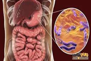 توصیه های تغذیه ای برای بیماران مبتلا به هلیکوباکتر پیلوری