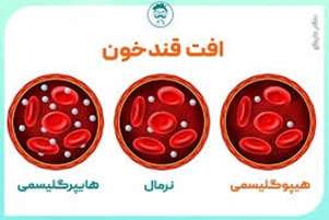 افتِ قند خون در بیماری دیابت علل، علائم و راهکار درمانی