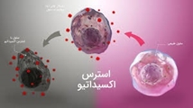 استرس اکسیداتیو