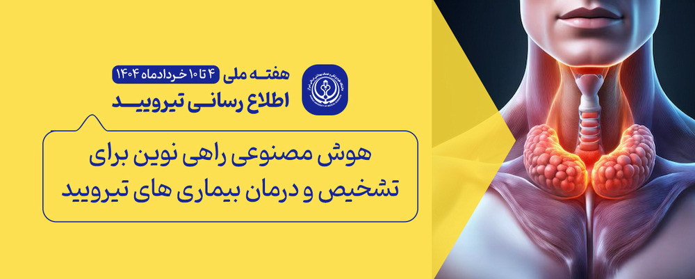 تیرویید